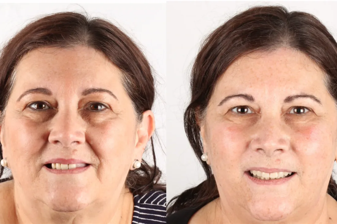 Before and after: patient who came from the USA to Brazil