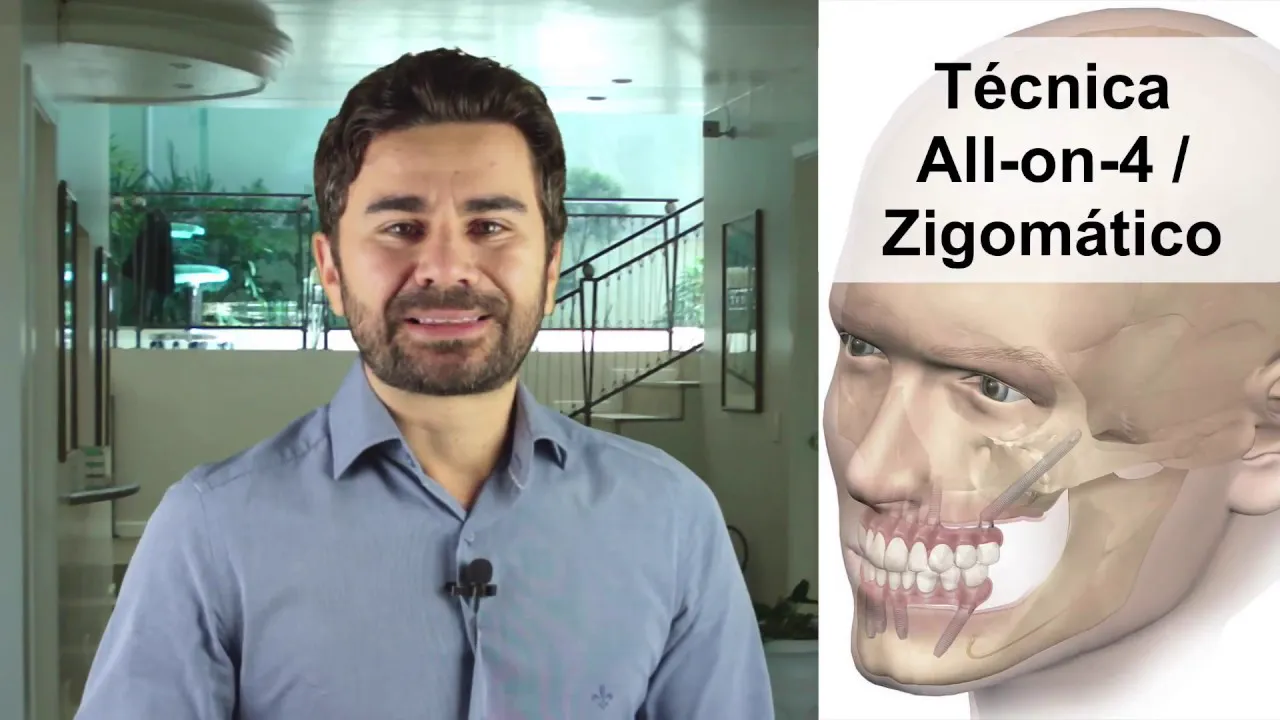 Depoimento: paciente que passou pelo enxerto do ilíaco e pelo zigomático